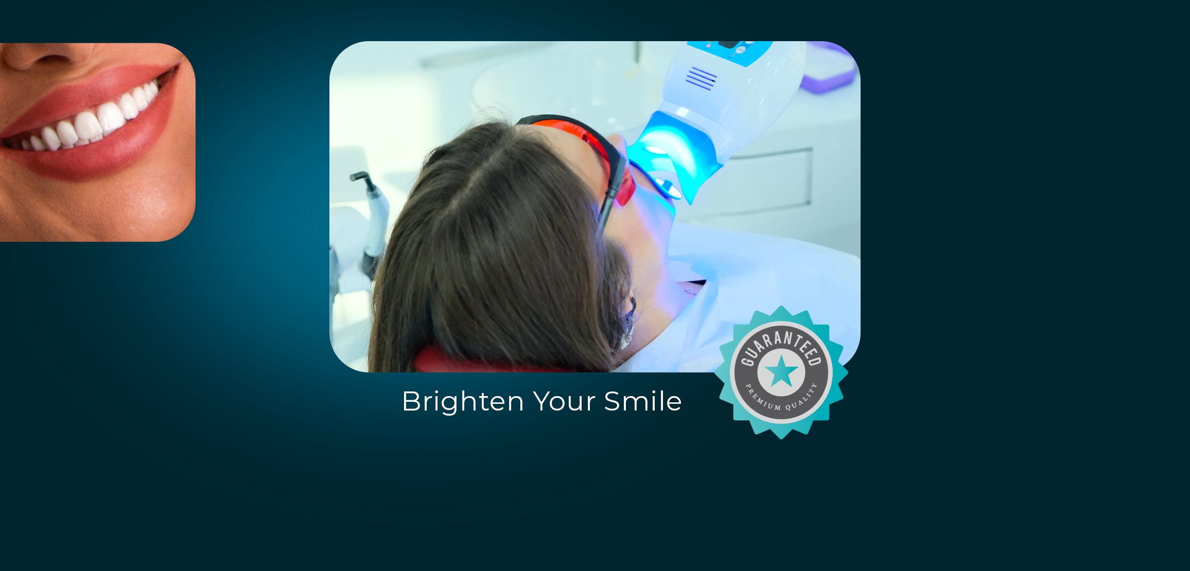 Teeth Whitening