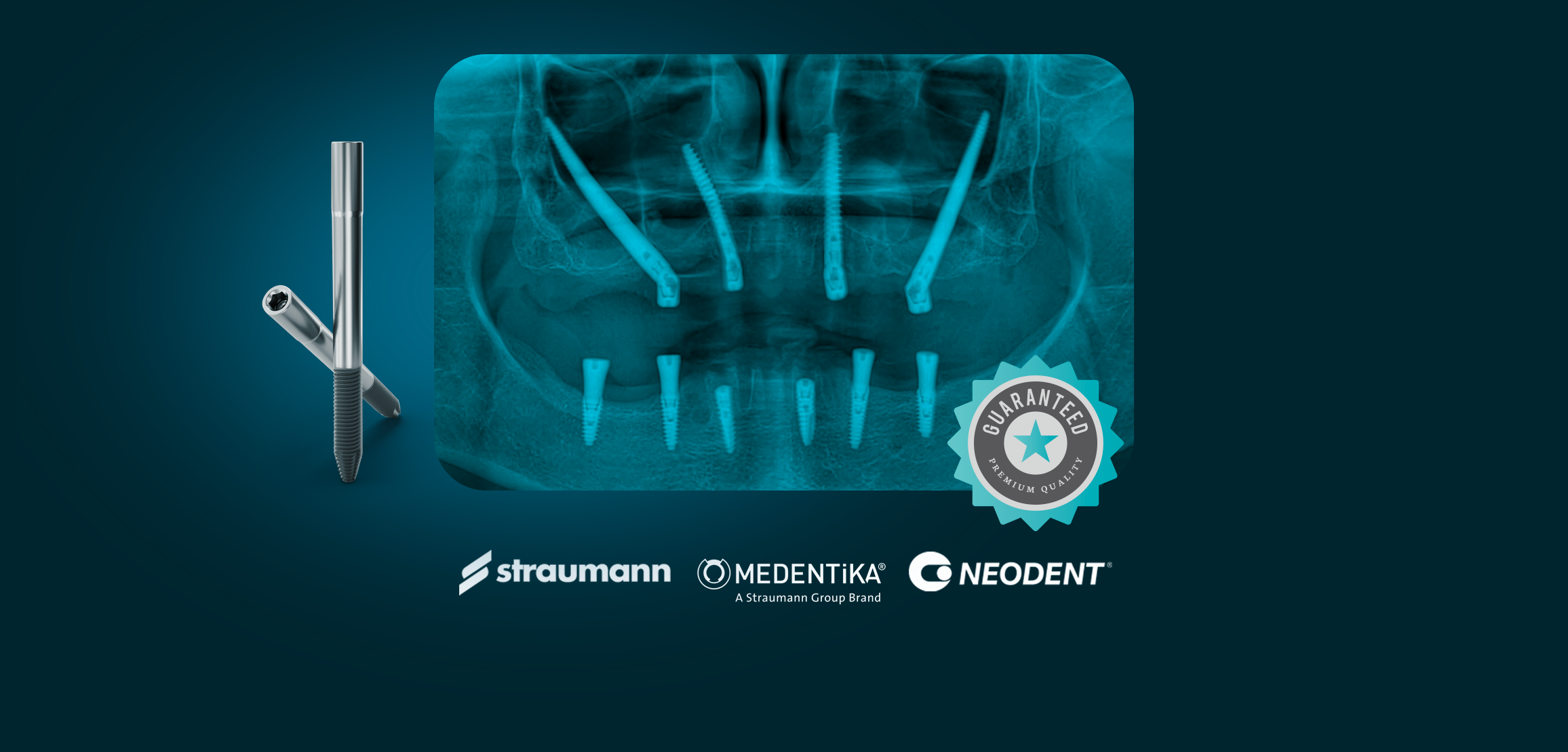 Zygomatic Implants